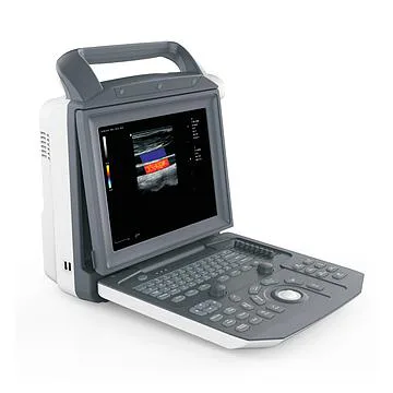 中旗 Zoncare 彩色多普勒超声系统 ZONCARE-V5(主机+腹部探头)