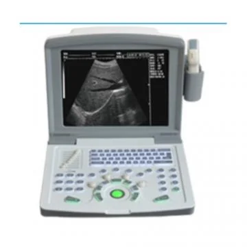 迈瑞Mindray全数字超声诊断系统RH-300A